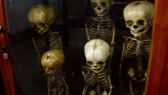 Exploring Immortality in Bangkok